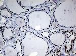 NBN Antibody in Immunohistochemistry (Paraffin) (IHC (P))