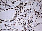 NBN Antibody in Immunohistochemistry (Paraffin) (IHC (P))