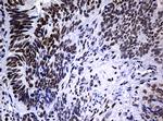 NBN Antibody in Immunohistochemistry (Paraffin) (IHC (P))