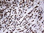 NBN Antibody in Immunohistochemistry (Paraffin) (IHC (P))