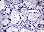 NBN Antibody in Immunohistochemistry (Paraffin) (IHC (P))