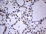 NBN Antibody in Immunohistochemistry (Paraffin) (IHC (P))