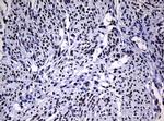 NBN Antibody in Immunohistochemistry (Paraffin) (IHC (P))