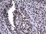 NBN Antibody in Immunohistochemistry (Paraffin) (IHC (P))