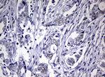 NBN Antibody in Immunohistochemistry (Paraffin) (IHC (P))