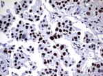 NBN Antibody in Immunohistochemistry (Paraffin) (IHC (P))