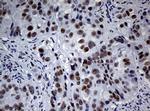 NBN Antibody in Immunohistochemistry (Paraffin) (IHC (P))