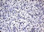 NBN Antibody in Immunohistochemistry (Paraffin) (IHC (P))