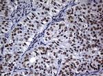 NBN Antibody in Immunohistochemistry (Paraffin) (IHC (P))