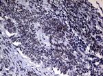 NBN Antibody in Immunohistochemistry (Paraffin) (IHC (P))