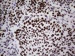 NBN Antibody in Immunohistochemistry (Paraffin) (IHC (P))