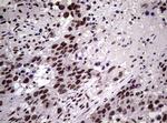 NBN Antibody in Immunohistochemistry (Paraffin) (IHC (P))