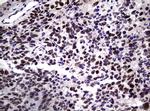 NBN Antibody in Immunohistochemistry (Paraffin) (IHC (P))