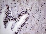 NBN Antibody in Immunohistochemistry (Paraffin) (IHC (P))