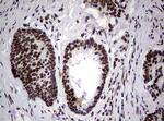 NBN Antibody in Immunohistochemistry (Paraffin) (IHC (P))