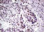 NBN Antibody in Immunohistochemistry (Paraffin) (IHC (P))