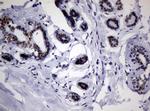 NBN Antibody in Immunohistochemistry (Paraffin) (IHC (P))