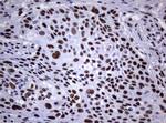 NBN Antibody in Immunohistochemistry (Paraffin) (IHC (P))