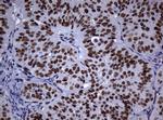 NBN Antibody in Immunohistochemistry (Paraffin) (IHC (P))