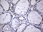 NBN Antibody in Immunohistochemistry (Paraffin) (IHC (P))