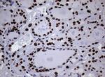 NBN Antibody in Immunohistochemistry (Paraffin) (IHC (P))