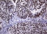 NBN Antibody in Immunohistochemistry (Paraffin) (IHC (P))