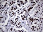 NBN Antibody in Immunohistochemistry (Paraffin) (IHC (P))