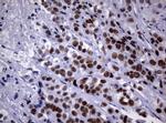 NBN Antibody in Immunohistochemistry (Paraffin) (IHC (P))