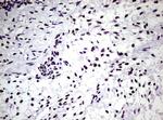 NBN Antibody in Immunohistochemistry (Paraffin) (IHC (P))