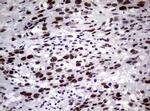 NBN Antibody in Immunohistochemistry (Paraffin) (IHC (P))