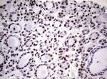 NBN Antibody in Immunohistochemistry (Paraffin) (IHC (P))