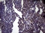 NBN Antibody in Immunohistochemistry (Paraffin) (IHC (P))