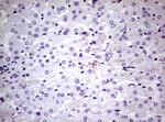 NBN Antibody in Immunohistochemistry (Paraffin) (IHC (P))