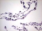 NBN Antibody in Immunohistochemistry (Paraffin) (IHC (P))