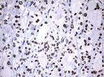 NBN Antibody in Immunohistochemistry (Paraffin) (IHC (P))