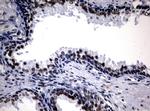 NBN Antibody in Immunohistochemistry (Paraffin) (IHC (P))