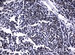 NBN Antibody in Immunohistochemistry (Paraffin) (IHC (P))