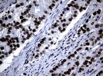 NBN Antibody in Immunohistochemistry (Paraffin) (IHC (P))