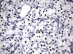 NBN Antibody in Immunohistochemistry (Paraffin) (IHC (P))