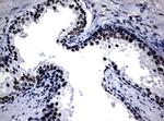 NBN Antibody in Immunohistochemistry (Paraffin) (IHC (P))