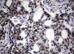 NBN Antibody in Immunohistochemistry (Paraffin) (IHC (P))