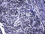 NBN Antibody in Immunohistochemistry (Paraffin) (IHC (P))