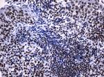 NBN Antibody in Immunohistochemistry (Paraffin) (IHC (P))