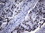 NBN Antibody in Immunohistochemistry (Paraffin) (IHC (P))