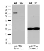 NBN Antibody