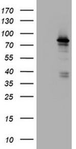 NBN Antibody in Western Blot (WB)