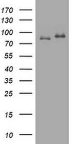 NBN Antibody in Western Blot (WB)