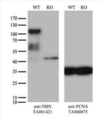 NBN Antibody in Western Blot (WB)