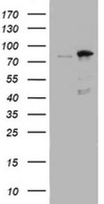 NBN Antibody in Western Blot (WB)