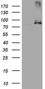 NBN Antibody in Western Blot (WB)